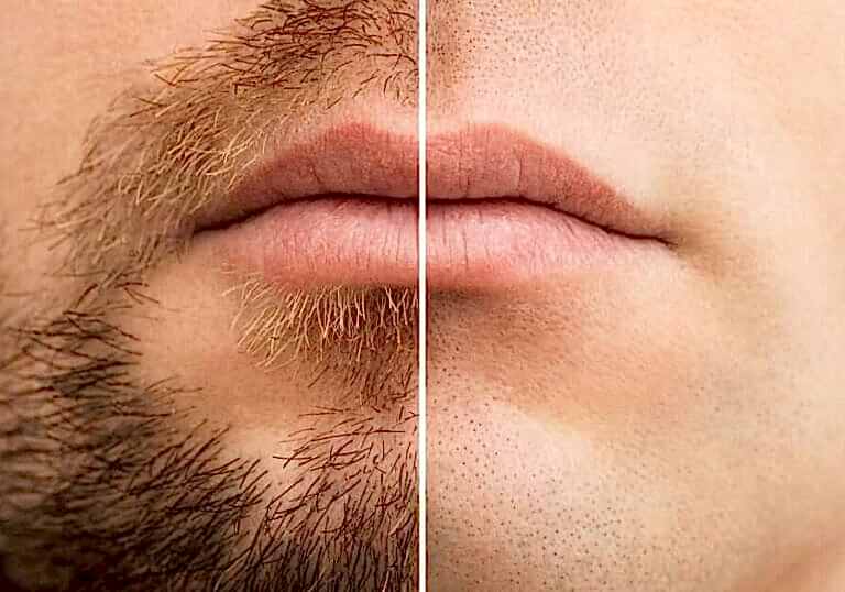 Dejarte crecer mumbai barba